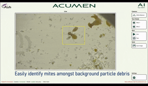 ASH Acumen AI Verfolgung in Echtzeit