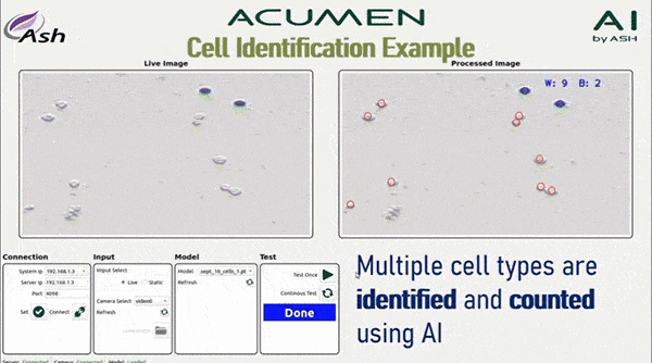 ASH Acumen AI Automatisches Zählen
