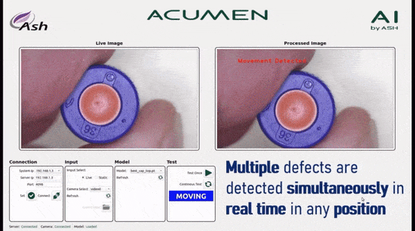 ASH Acumen AI Erkennung in Echtzeit